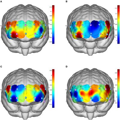 Acute effects of different exercise forms on executive function and the mechanism of cerebral hemodynamics in hospitalized T2DM patients: a within-subject study